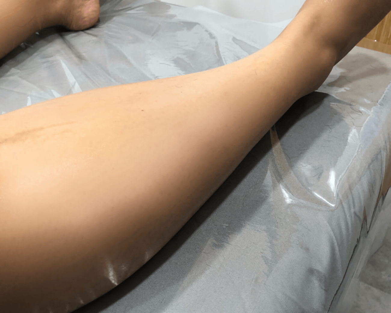 leg hair removal